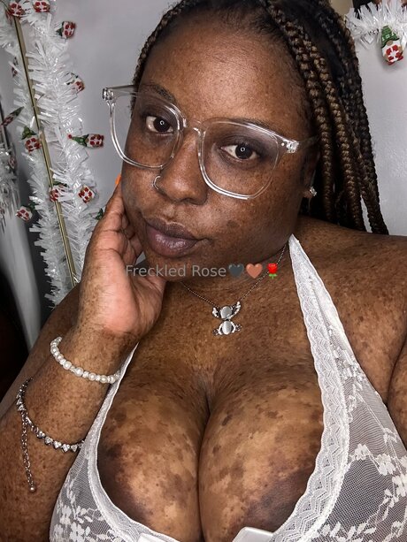 Freckledfantasy5 adult actress img