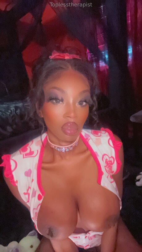 Toplesstherapist exclusive star photos