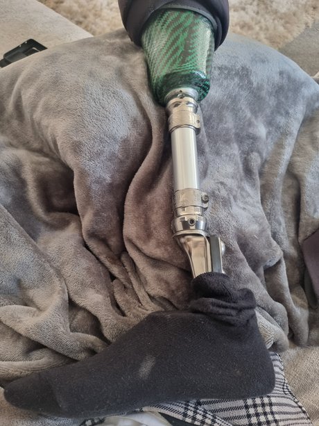 Stumpy sex model photos