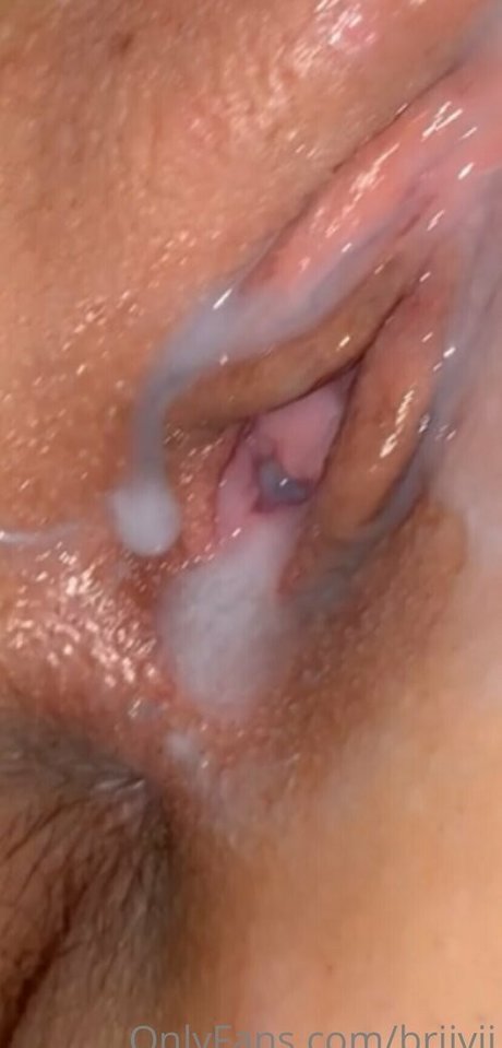amputee onlyfans pretty galleries