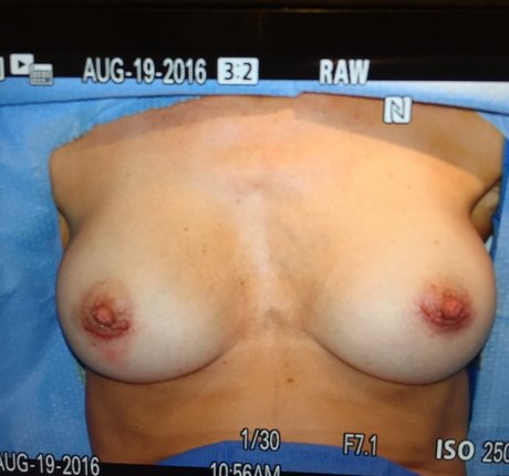 Kate Winslet star nudes pic