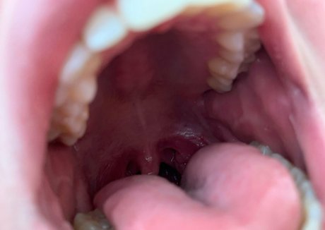 aliceeats star exclusive images