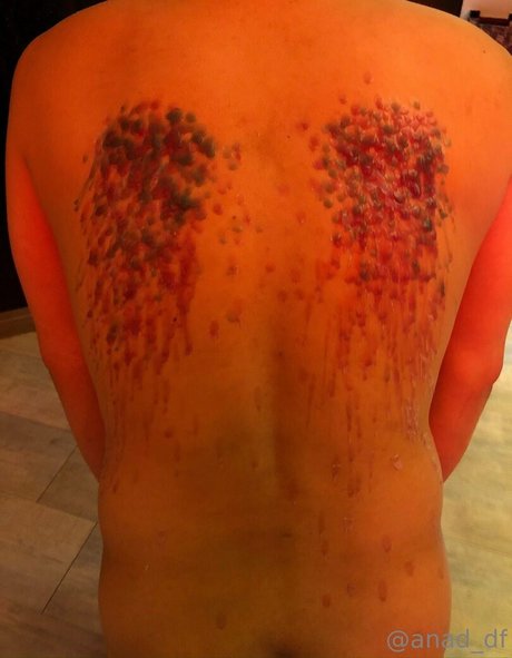 anad df hot star picture