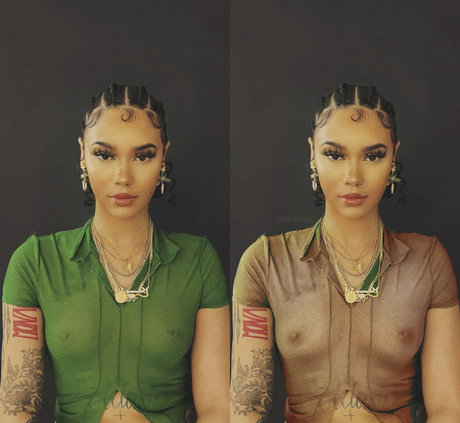 My Xray Work model top images