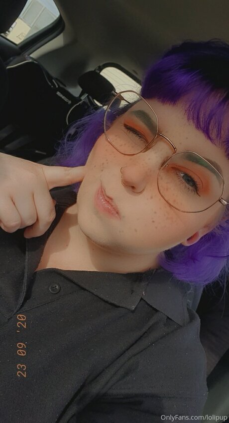 Lolipup top star photos