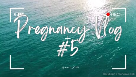 Xoxo Cali art star gallery