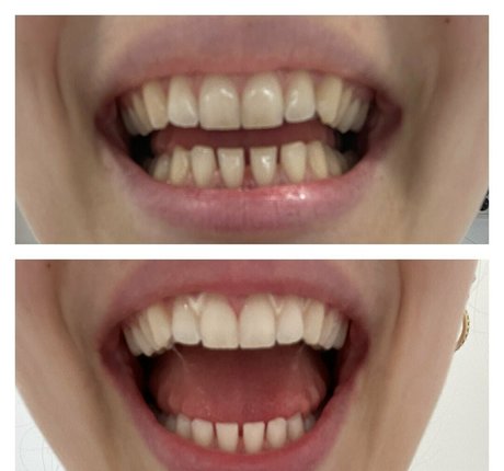 black milf onlyfans adult gallery