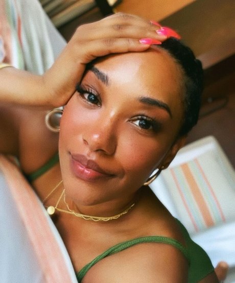 Candice Patton star xxx photos