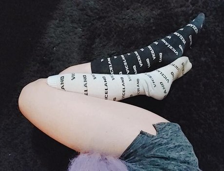 achilles heelz perfect star img