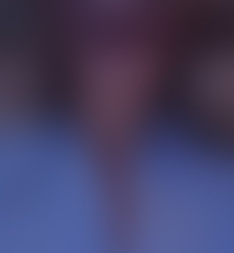 Ofanto model top picture