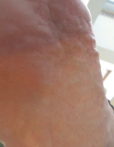 neolasoles free star pics