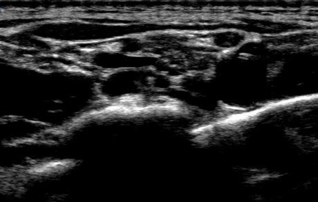 kacenna naked actress pics