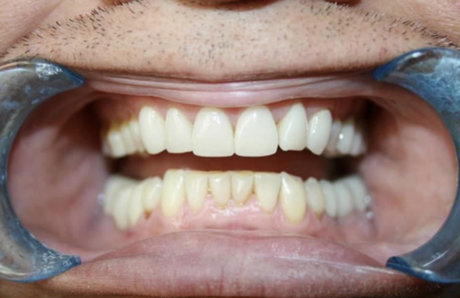 ToothFetish Doc naked star pics