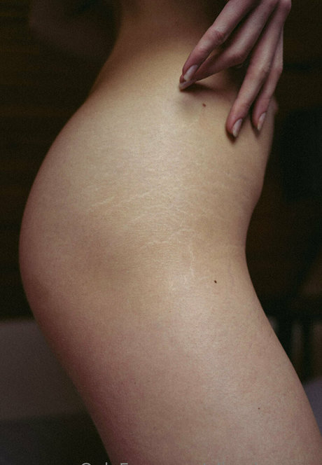 olimpiagreen star hot img