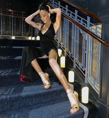 Winnie Harlow erotic pornstar pics