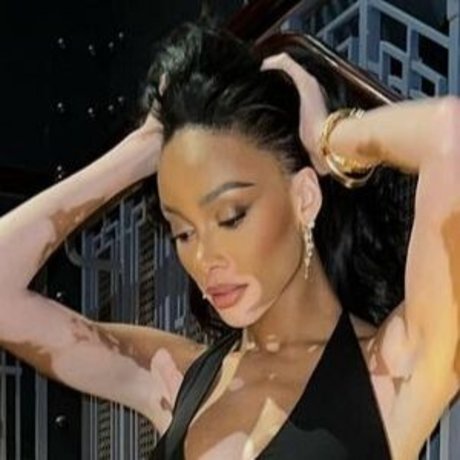 Winnie Harlow pornstar perfect galleries