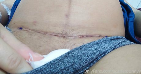 scarletbunnyy model naked image