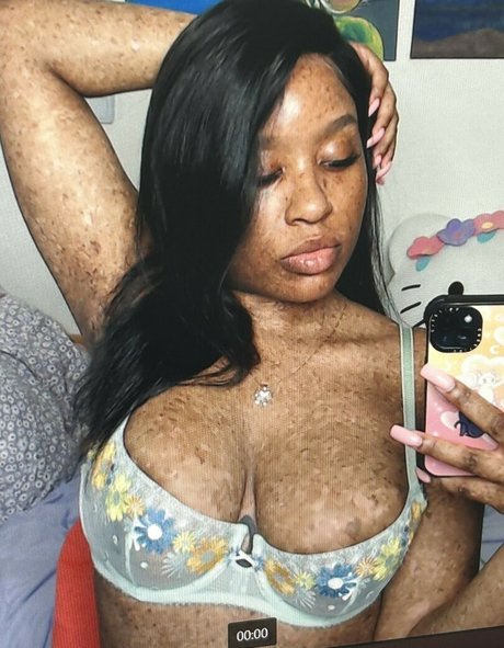 freckledn actress photo