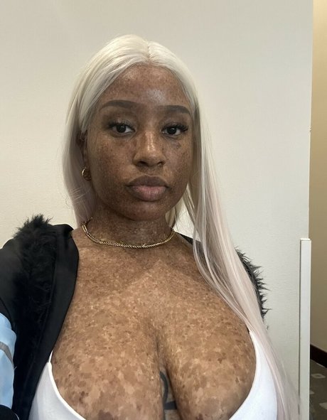 freckledn high quality model photos