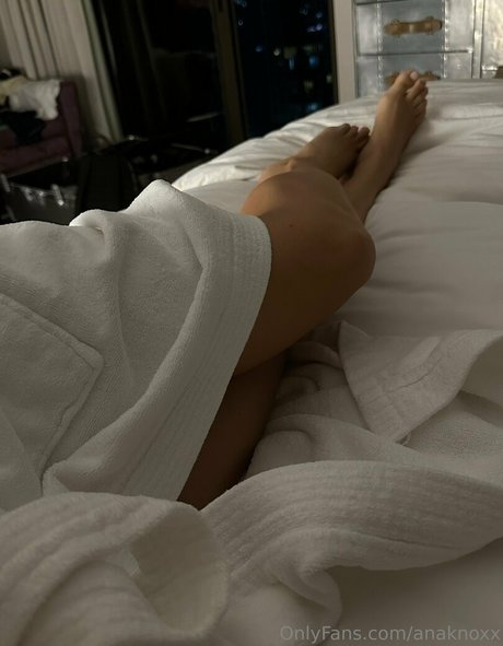 anaknoxx top model gallery