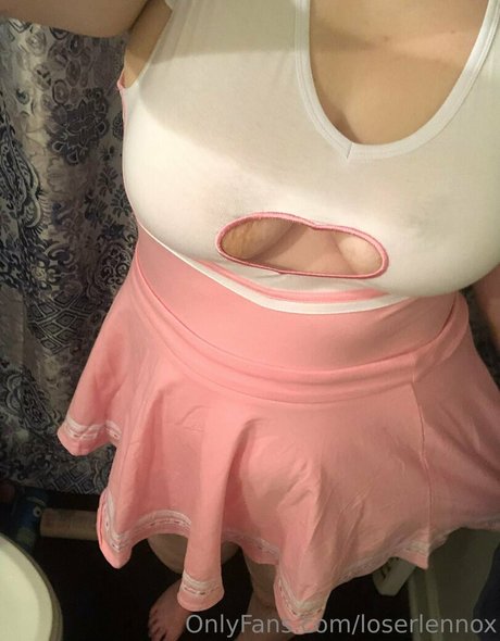 loserlennox star sexy pics
