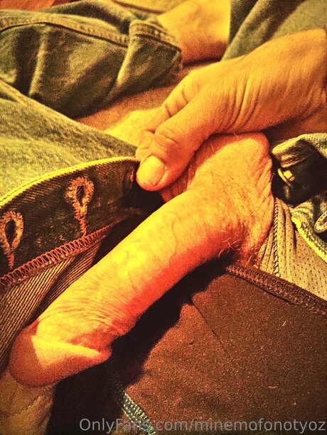 Minemofonotyoz model perfect image