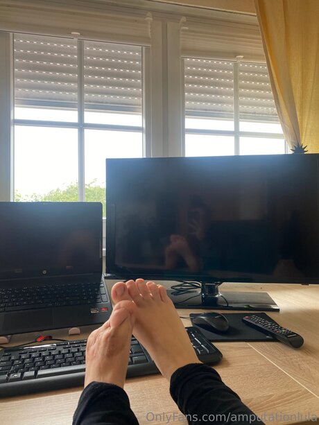 Amputationlula model picture