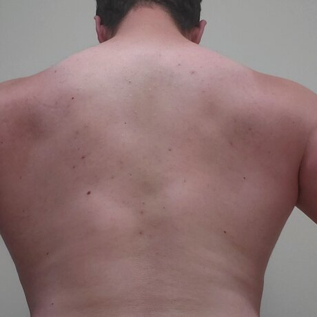 Andrew dennis nudes actress image