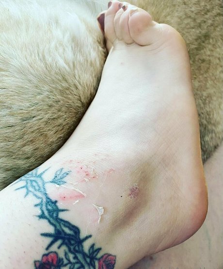 val acanthus model best image