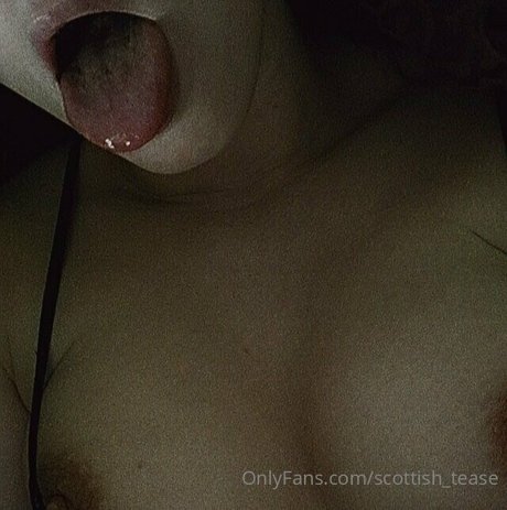 scottish tease star top photo