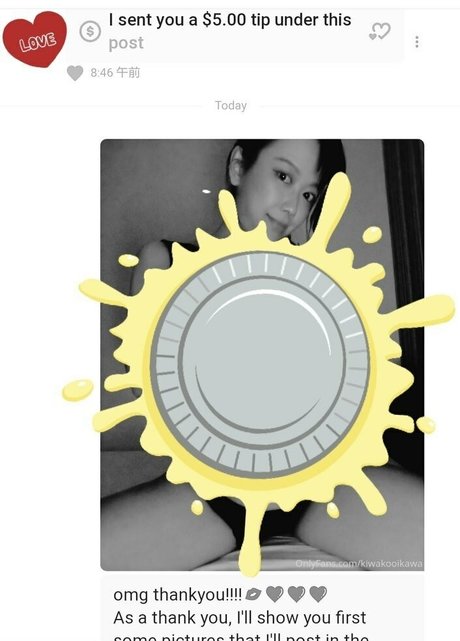 kiwakooikawa exclusive star galleries