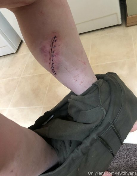 lewdhyena model nice pic