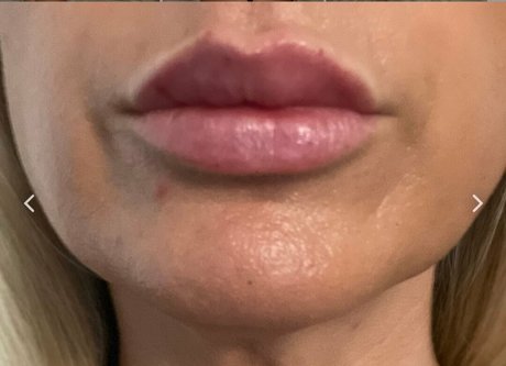 Nipsstrips beautiful star pictures