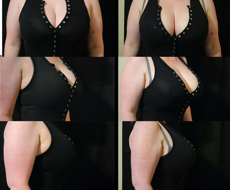 dennadoll naked actress gallery