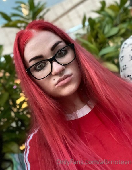 albinoteen erotic model photo