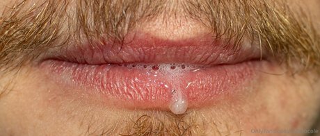 macrocole star nice photos