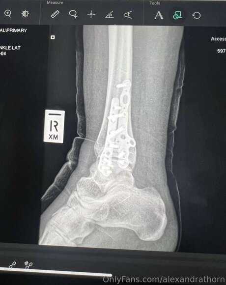 alexandrathorn pornstar hd archive