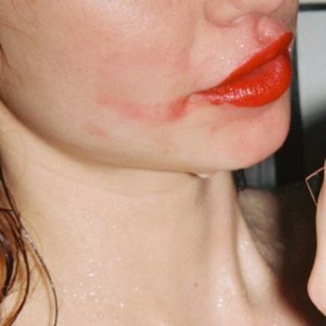 Herbert Twins model adult image