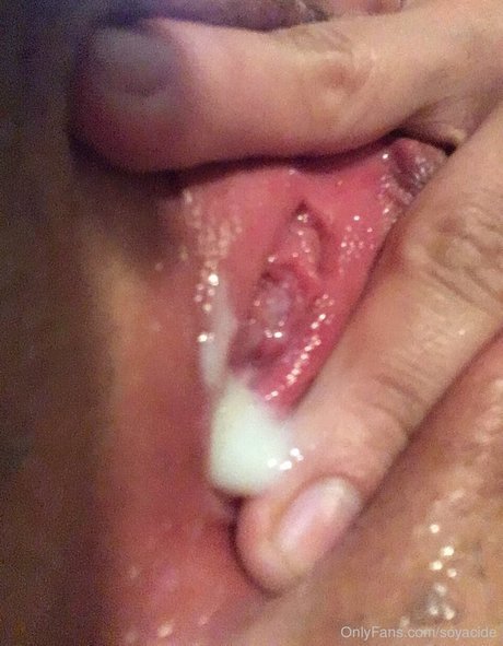 Soyacide nudes star pic