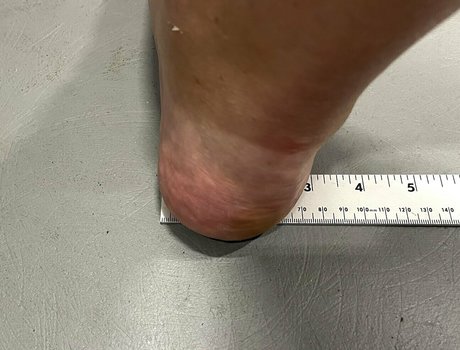 amazonlynn model pornographic img