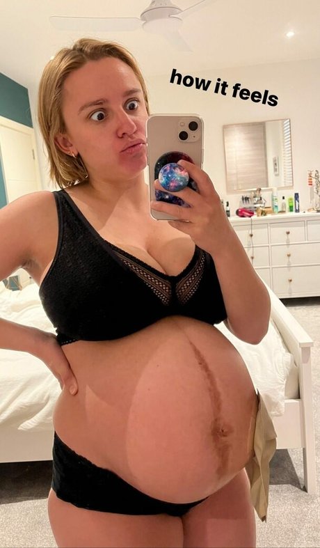 Hannah Witton beautiful model galleries