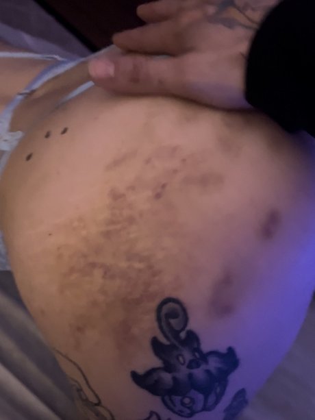 Birth defect pretty star images