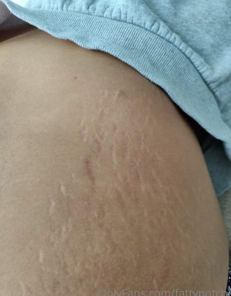 fattypotchi nudes model img