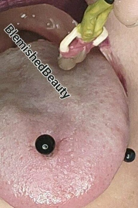 blemishedbeauty perfect star pic