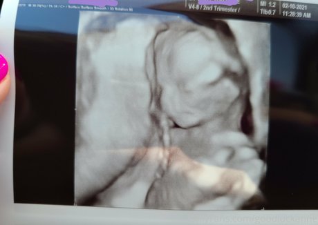 goodluckanne model sex photos