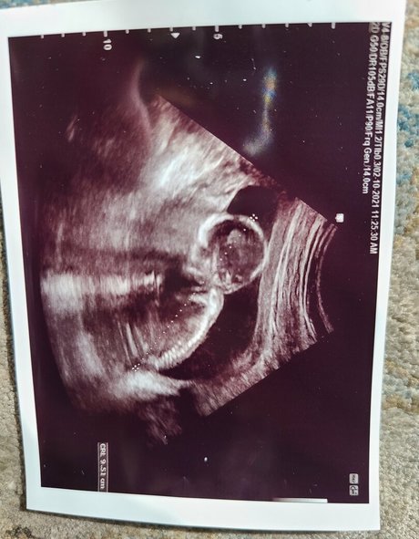 goodluckanne star nude image