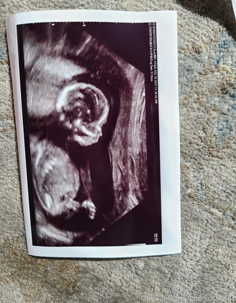 goodluckanne model hd galleries