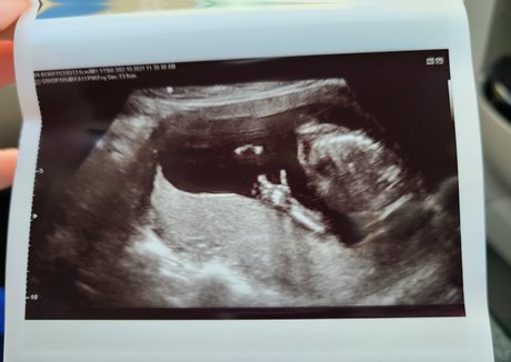 goodluckanne Profile pic