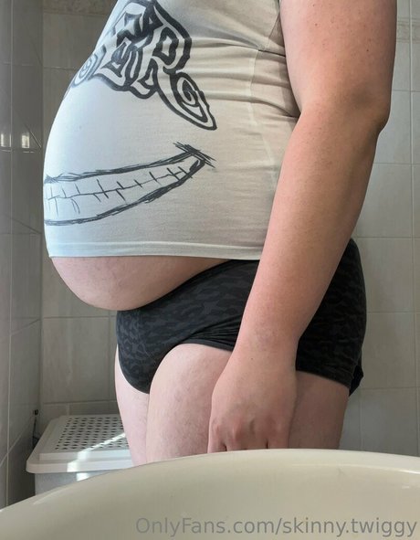 skinny twiggy exclusive star photos