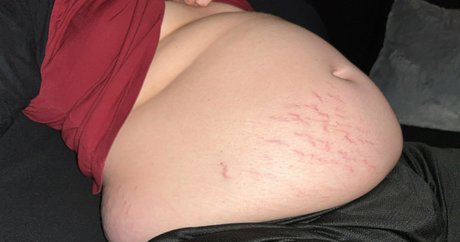 skinny twiggy model beautiful image